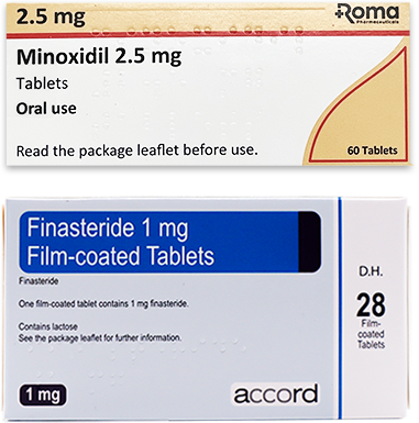 Minoxidil And Finasteride Tablets For Hair Loss