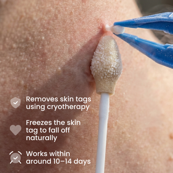 Cryotag Skin Tag Remover