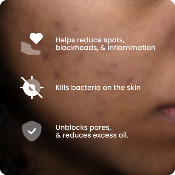 Acnecide Gel