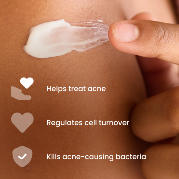 Epiduo Gel
